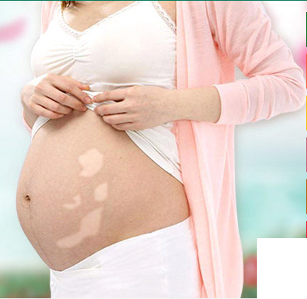 为什么孕妇肚子上面会出现白斑呢