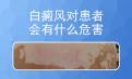 北京白癜风初期治专家解析-白癜风对人的身体有哪些危害