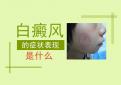 北京治白癜风的好医院：泛发型白癜风的症状表现有哪些