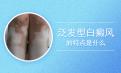 北京白癜风专业治疗：白癜风发病有什么特点?