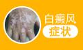 北京白癜风正规医院讲解白癜风易发部位的症状都有哪些