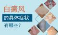 【北京白癜风得病的原因】皮肤发痒是白驳风一种病发特征